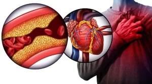 آستاگزانتین و نارسایی قلبی